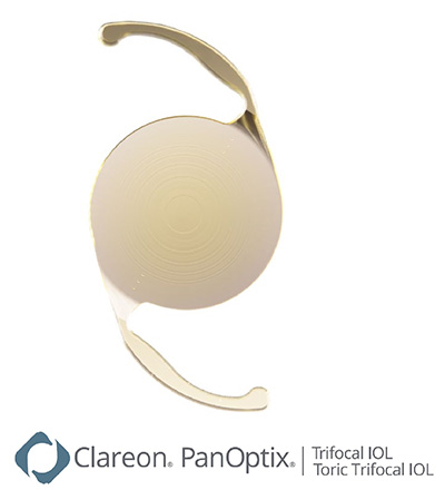 ClareonR PanOptixR トリフォーカル